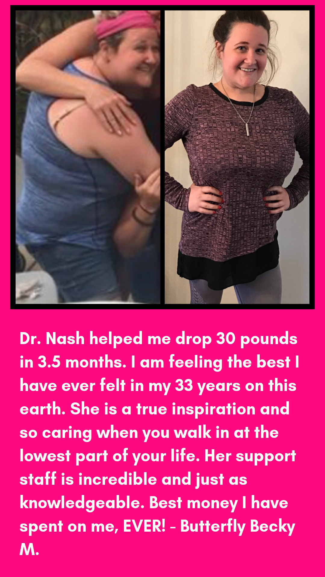 drnash.com before and after weight loss photo