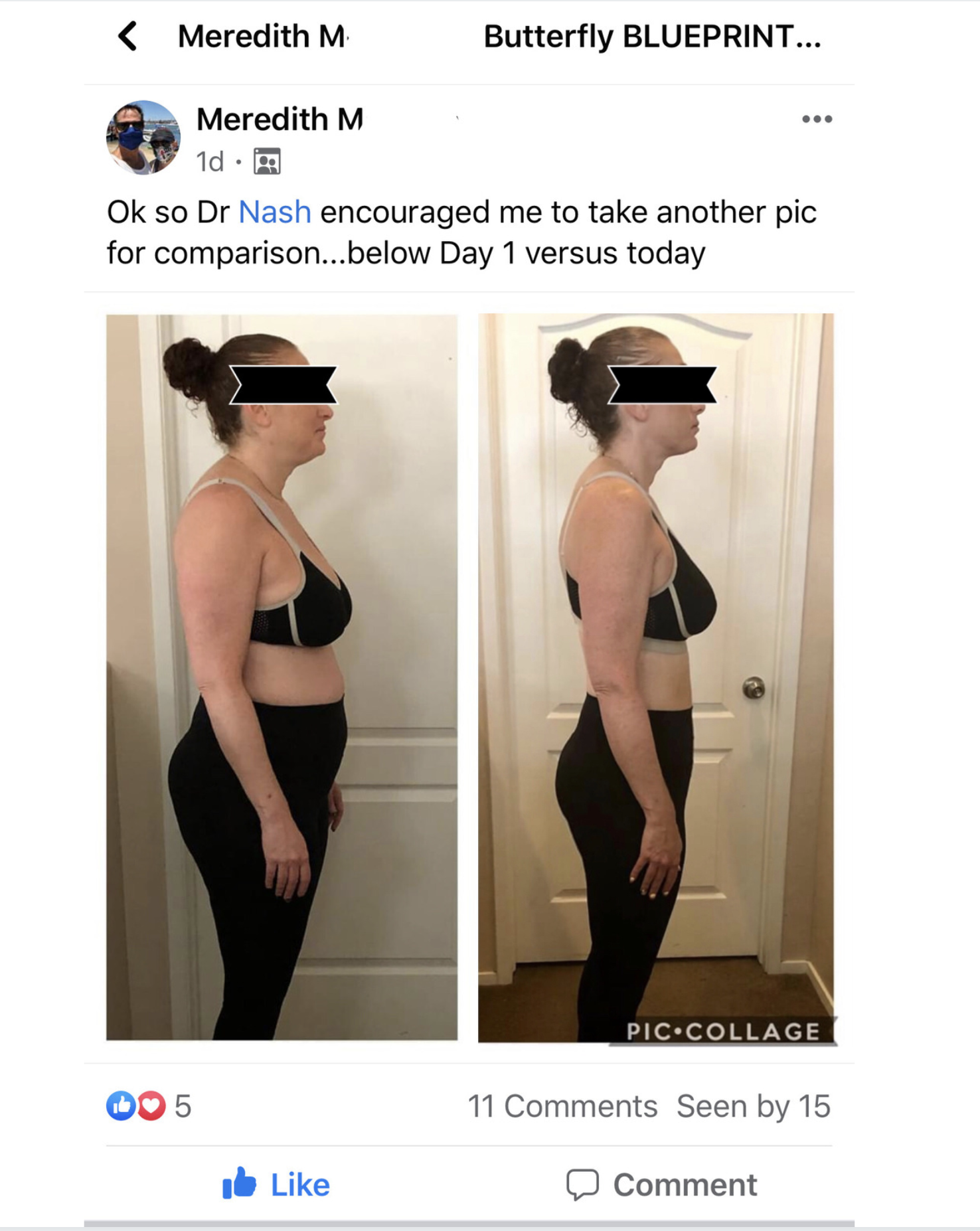 Dr. Nash Metabolic Weight Loss Program Before and After Photograph